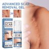 Oceaura Scar Repair Gel Moisturizes And Smooths Skin Repair
