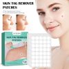 Skin Tag Removal Patches Smooth Skin using  Cleansing Care Patch Jaysuing Keyu